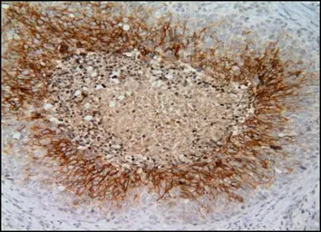 Anti-Carbonic Anhydrase IX antibody [GT12] used in IHC (Paraffin sections) (IHC-P). GTX70020